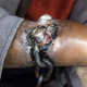 Illustration for article titled Why Are Chains Growing Out Of This Mans Skin?